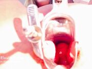 Elouise Please - Speculum Study