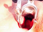 Elouise Please - Speculum Study