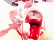 Elouise Please - Speculum Study