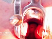 Elouise Please - Speculum Study