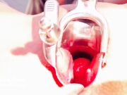 Elouise Please - Speculum Study