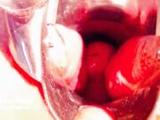 Elouise Please - Speculum Study