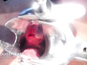 Elouise Please - Tipsy Speculum Play