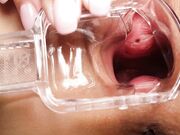 AsianDreamX - Anal Through Speculum