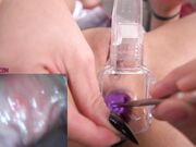 AsianDreamX - Cervix Urethra Anal Endoscope Exloration