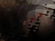 Lauren Rules - There Is No Cure For Lauren